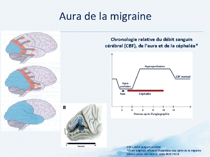 Aura de la migraine Chronologie relative du débit sanguin cérébral (CBF), de l’aura et Aura de la migraine Chronologie relative du débit sanguin cérébral (CBF), de l’aura et