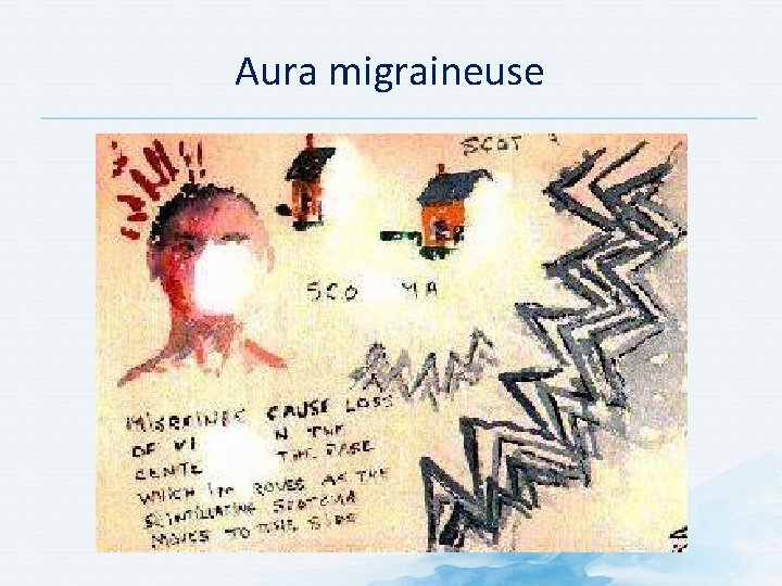 Aura migraineuse Aura migraineuse