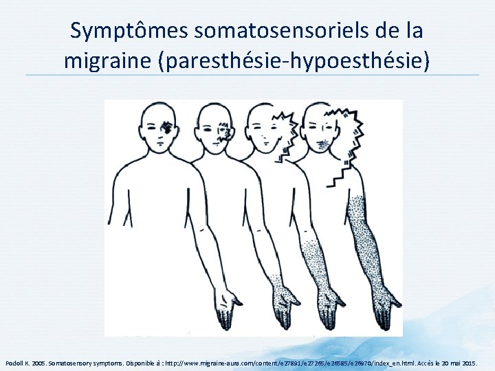 Symptômes somatosensoriels de la migraine (paresthésie hypoesthésie) Podoll K. 2005. Somatosensory symptoms. Disponible à Symptômes somatosensoriels de la migraine (paresthésie hypoesthésie) Podoll K. 2005. Somatosensory symptoms. Disponible à