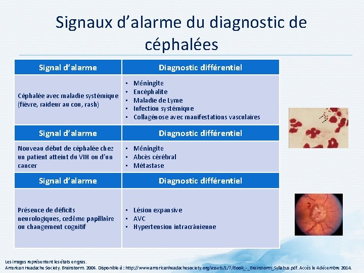 Signaux d’alarme du diagnostic de céphalées Signal d’alarme Diagnostic différentiel • • Céphalée avec Signaux d’alarme du diagnostic de céphalées Signal d’alarme Diagnostic différentiel • • Céphalée avec