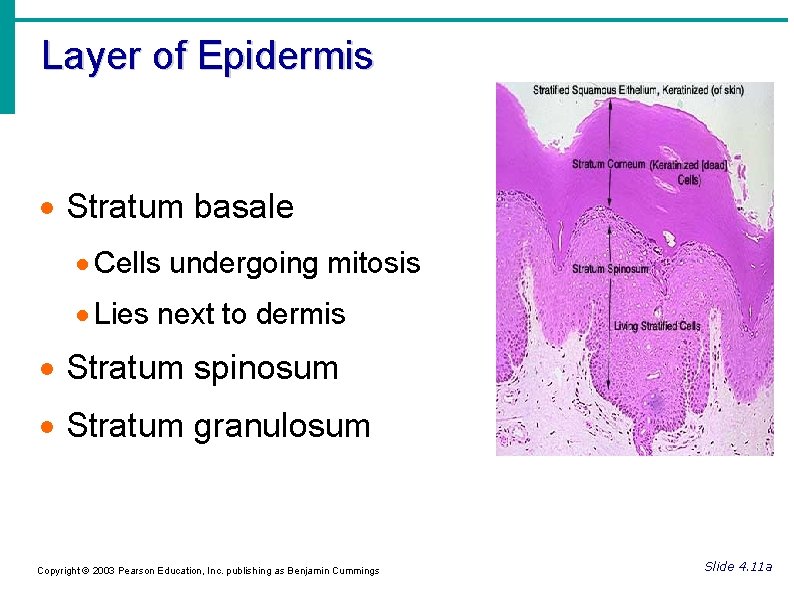 Layer of Epidermis Stratum basale Cells undergoing mitosis Lies next to dermis Stratum spinosum