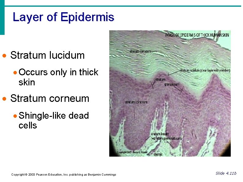 Layer of Epidermis Stratum lucidum Occurs only in thick skin Stratum corneum Shingle-like dead