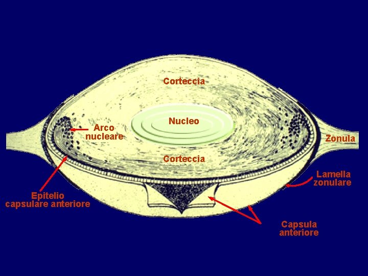 Corteccia Arco nucleare Nucleo Zonula Corteccia Lamella zonulare Epitelio capsulare anteriore Capsula anteriore 