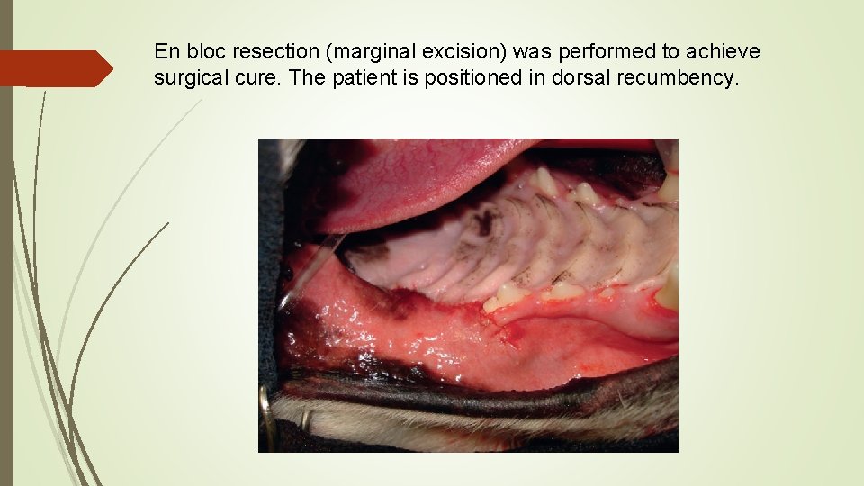 En bloc resection (marginal excision) was performed to achieve surgical cure. The patient is