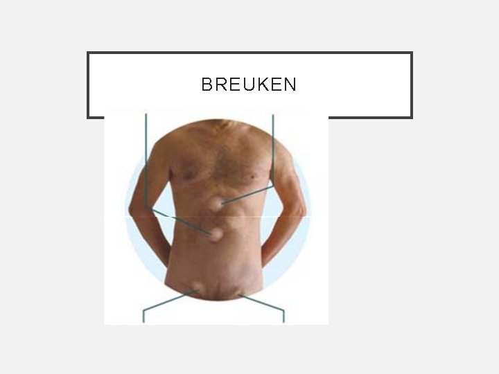BREUKEN 