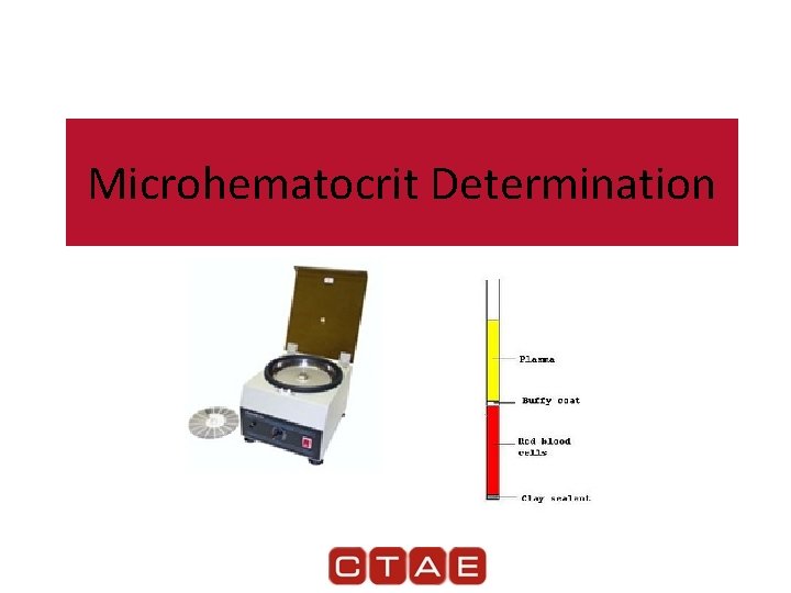 Microhematocrit Determination 