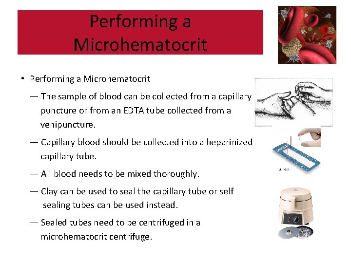 Performing a Microhematocrit • Performing a Microhematocrit — The sample of blood can be