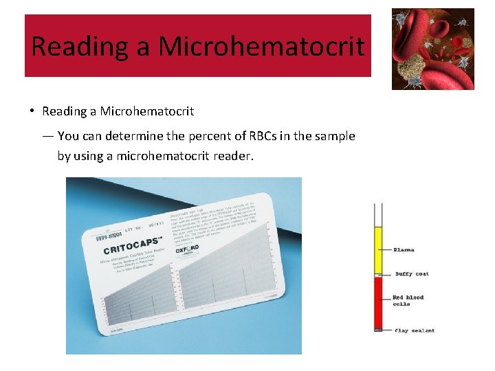 Reading a Microhematocrit • Reading a Microhematocrit — You can determine the percent of