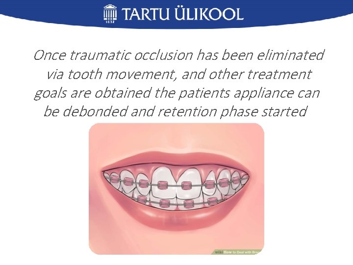 Once traumatic occlusion has been eliminated via tooth movement, and other treatment goals are