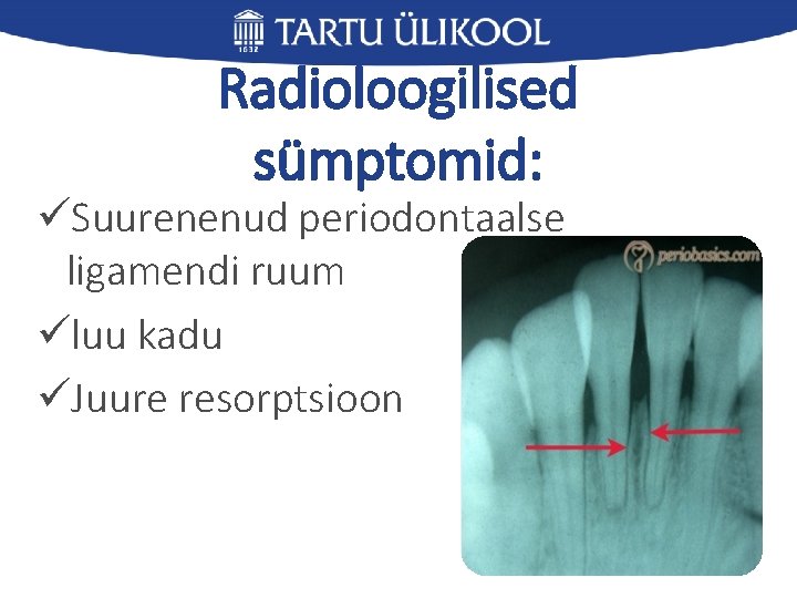 Radioloogilised sümptomid: üSuurenenud periodontaalse ligamendi ruum üluu kadu üJuure resorptsioon 