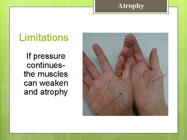 Atrophy Limitations If pressure continuesthe muscles can weaken and atrophy 