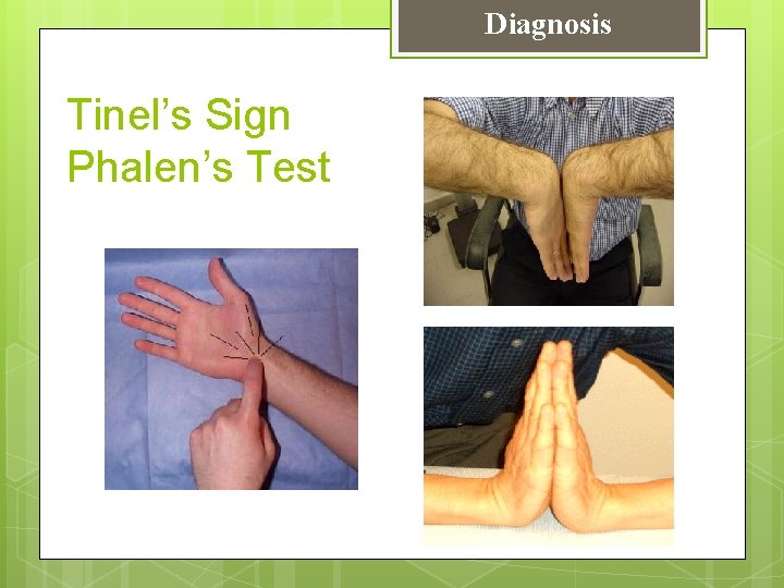 Diagnosis Tinel’s Sign Phalen’s Test 