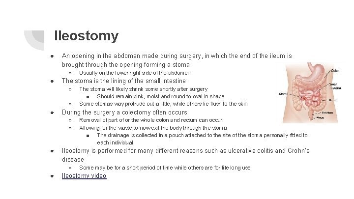 Ileostomy ● An opening in the abdomen made during surgery, in which the end