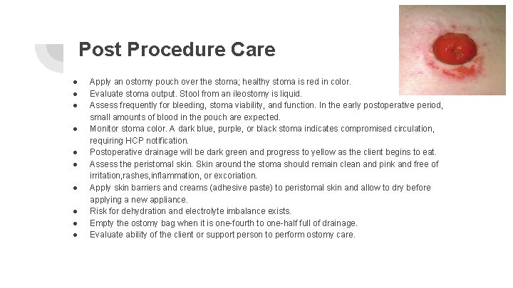 Post Procedure Care ● ● ● ● ● Apply an ostomy pouch over the