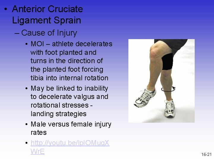  • Anterior Cruciate Ligament Sprain – Cause of Injury • MOI – athlete