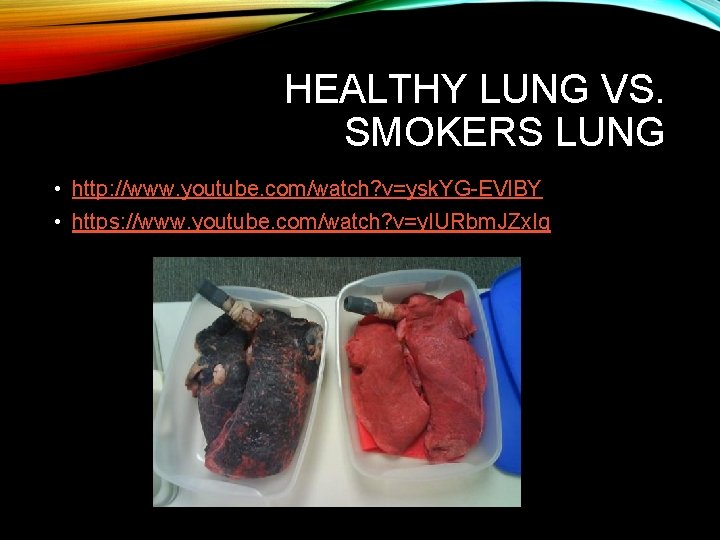 HEALTHY LUNG VS. SMOKERS LUNG • http: //www. youtube. com/watch? v=ysk. YG-EVl. BY • HEALTHY LUNG VS. SMOKERS LUNG • http: //www. youtube. com/watch? v=ysk. YG-EVl. BY •