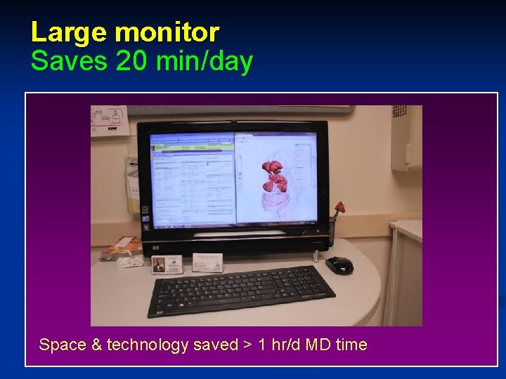 Large monitor Saves 20 min/day Space & technology saved > 1 hr/d MD time