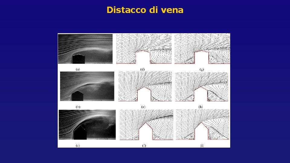 Distacco di vena Distacco di vena