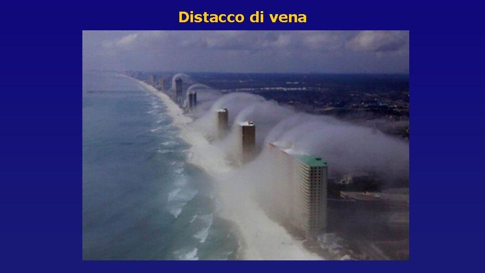 Distacco di vena Distacco di vena