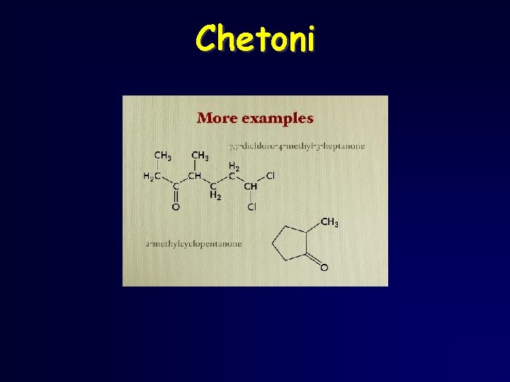 Chetoni Chetoni