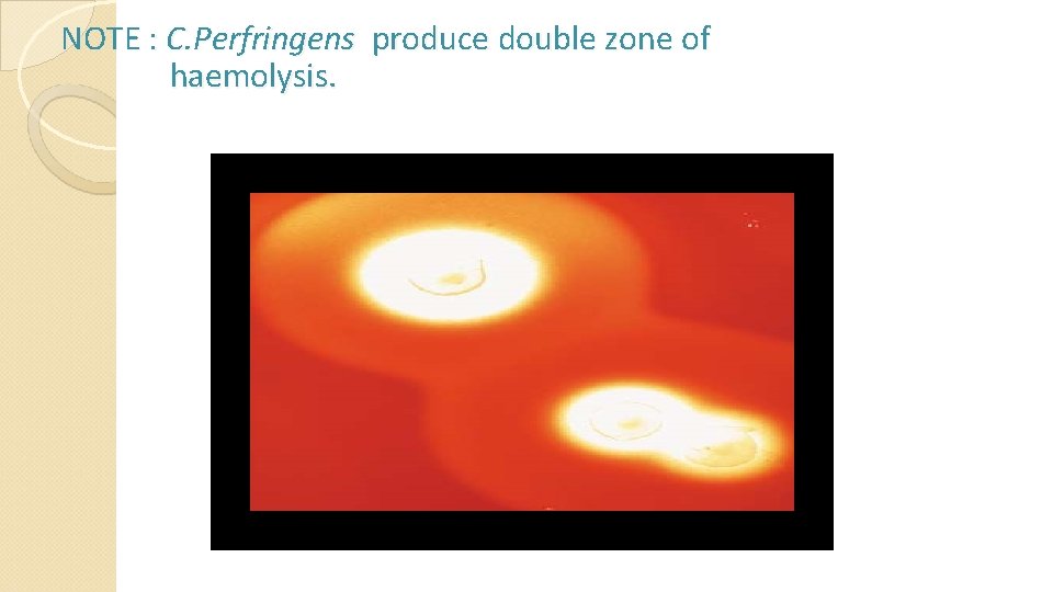 NOTE : C. Perfringens produce double zone of haemolysis. 