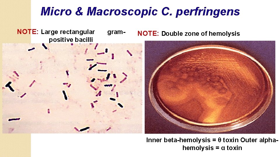 Micro & Macroscopic C. perfringens NOTE: Large rectangular positive bacilli gram- NOTE: Double zone