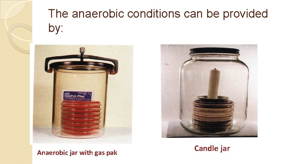 The anaerobic conditions can be provided by: Anaerobic jar with gas pak Candle jar