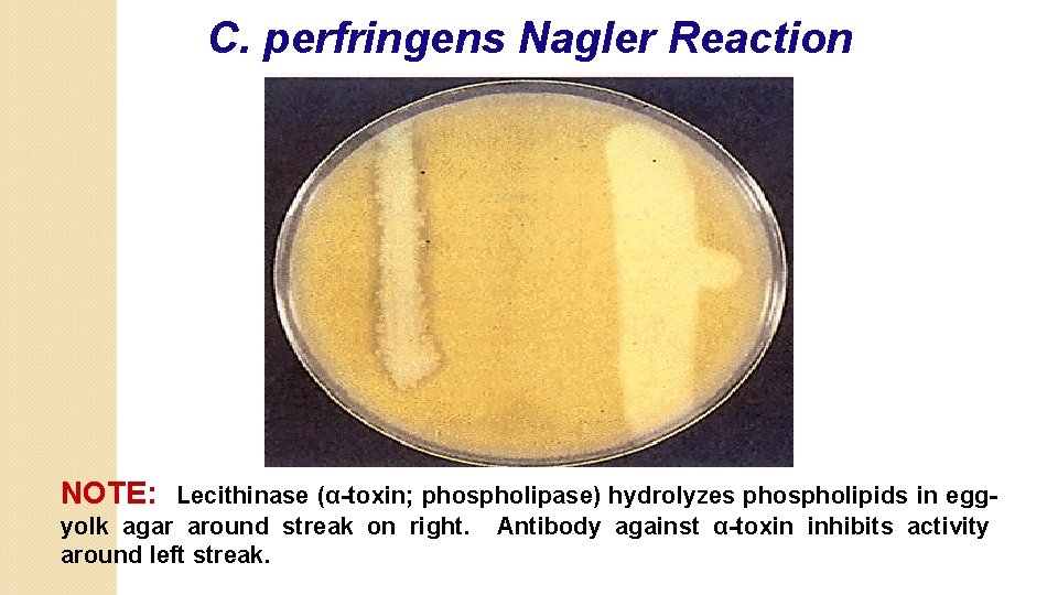 C. perfringens Nagler Reaction NOTE: Lecithinase (α-toxin; phospholipase) hydrolyzes phospholipids in eggyolk agar around