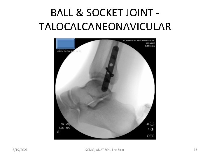 BALL & SOCKET JOINT TALOCALCANEONAVICULAR 2/19/2021 SCNM, ANAT 604, The Foot 13 