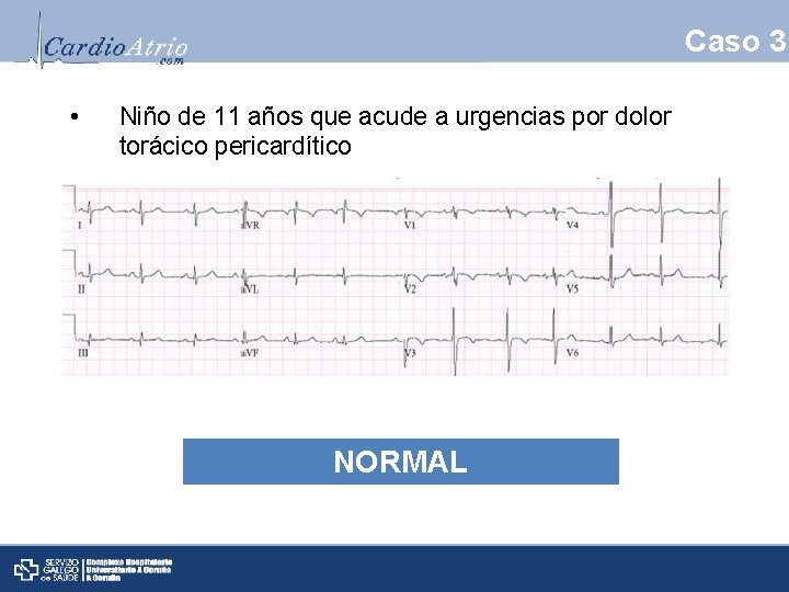 Caso 3 • Niño de 11 años que acude a urgencias por dolor torácico