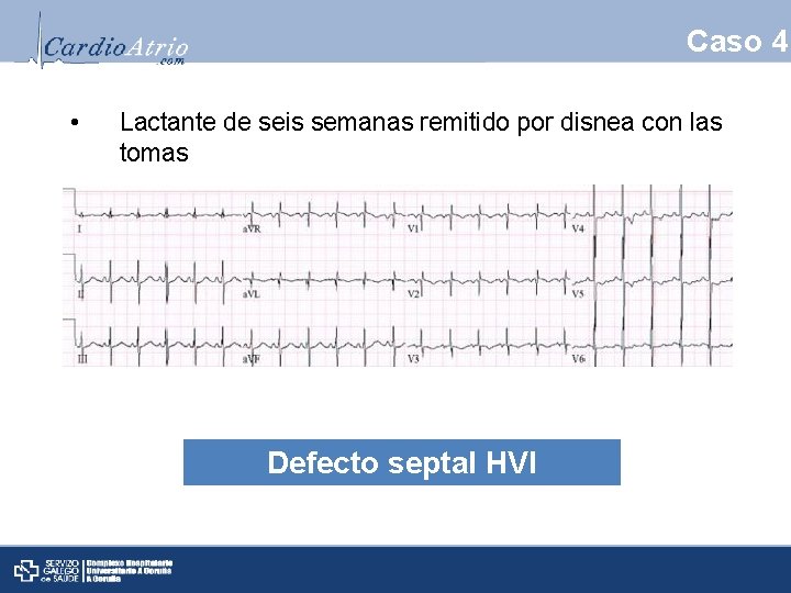 Caso 4 • Lactante de seis semanas remitido por disnea con las tomas Defecto