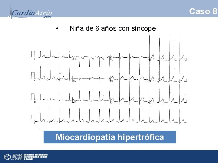 Caso 8 • Niña de 6 años con síncope Miocardiopatía hipertrófica 