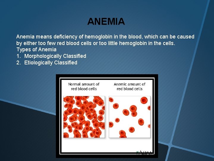 ANEMIA Anemia means deficiency of hemoglobin in the blood, which can be caused by