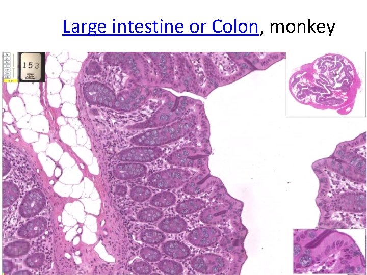 Large intestine or Colon, monkey 