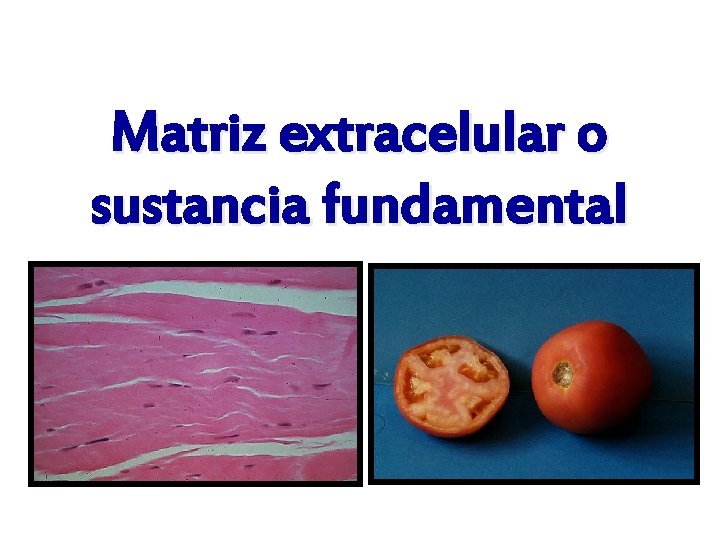 Matriz extracelular o sustancia fundamental 