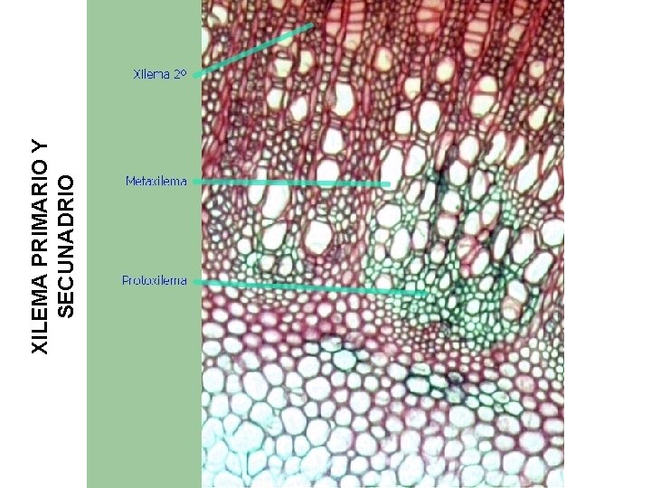 XILEMA PRIMARIO Y SECUNADRIO 