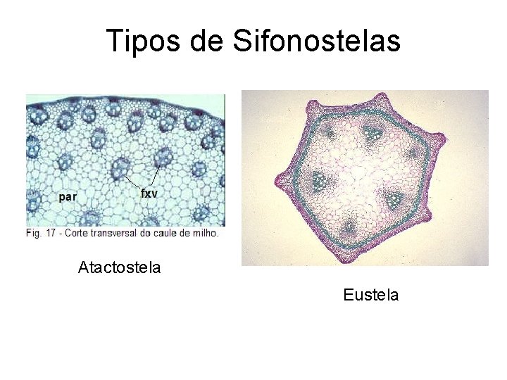 Tipos de Sifonostelas Atactostela Eustela 