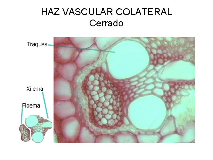 HAZ VASCULAR COLATERAL Cerrado 