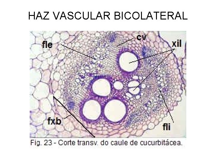 HAZ VASCULAR BICOLATERAL 