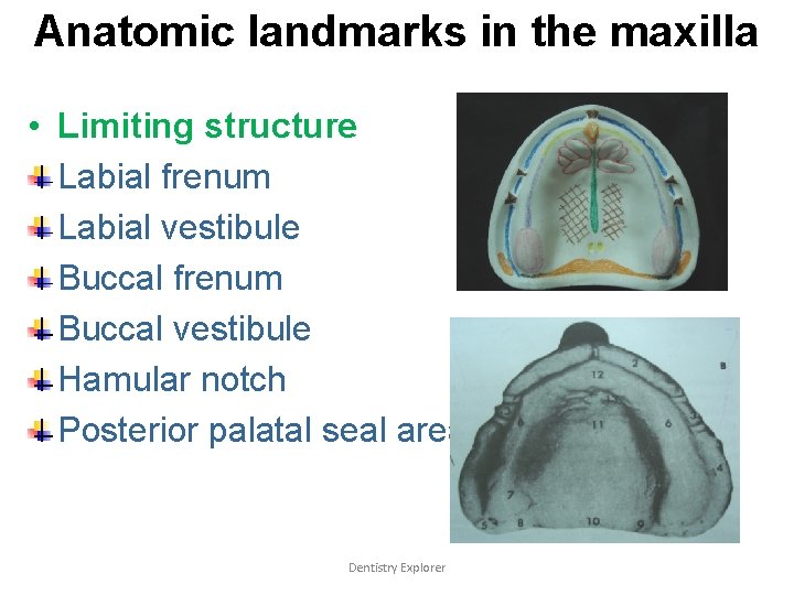 Anatomic landmarks in the maxilla • Limiting structure Labial frenum Labial vestibule Buccal frenum