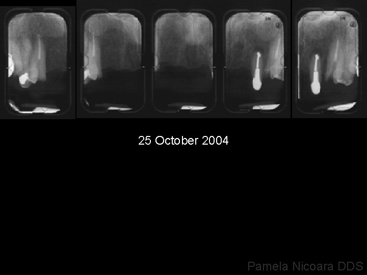25 October 2004 Pamela Nicoara DDS 