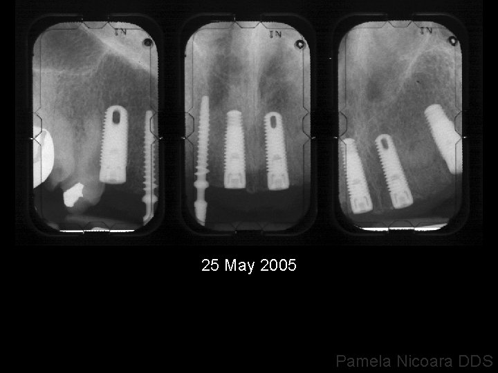 25 May 2005 Pamela Nicoara DDS 
