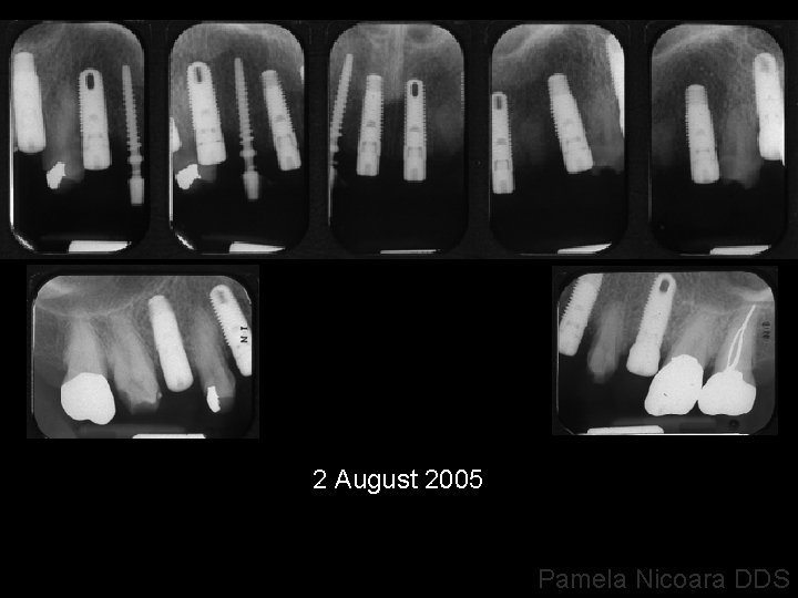 2 August 2005 Pamela Nicoara DDS 