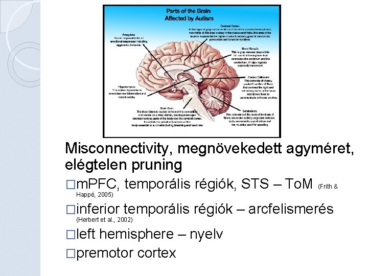 Misconnectivity, megnövekedett agyméret, elégtelen pruning �m. PFC, temporális régiók, STS – To. M (Frith Misconnectivity, megnövekedett agyméret, elégtelen pruning �m. PFC, temporális régiók, STS – To. M (Frith