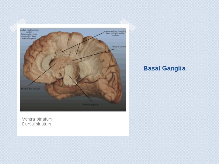 Basal Ganglia Ventral striatum Dorsal striatum Basal Ganglia Ventral striatum Dorsal striatum