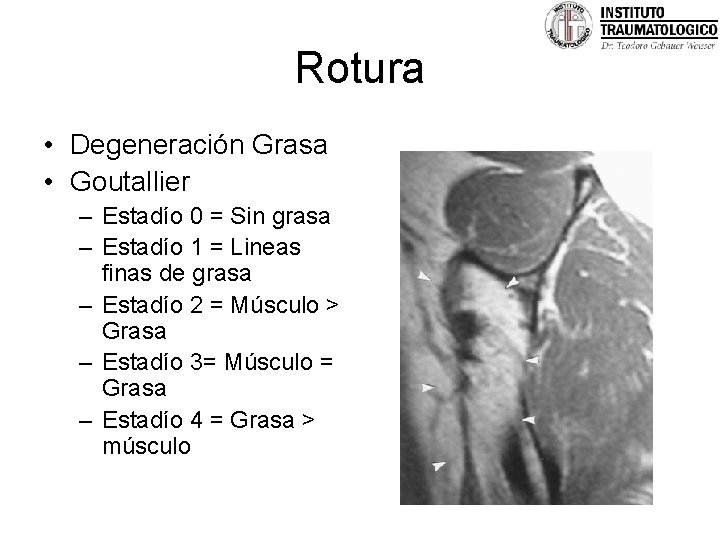 Rotura • Degeneración Grasa • Goutallier – Estadío 0 = Sin grasa – Estadío