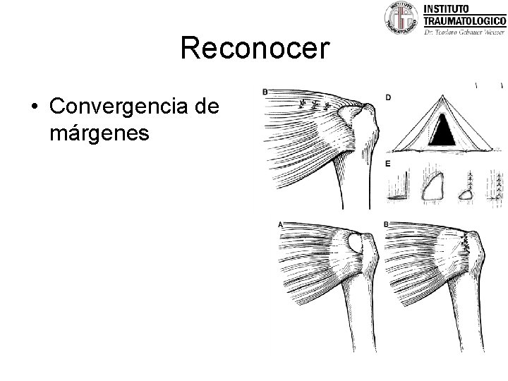 Reconocer • Convergencia de márgenes 