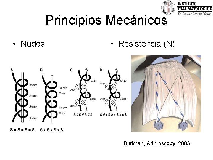 Principios Mecánicos • Nudos • Resistencia (N) Burkhart, Arthroscopy. 2003 