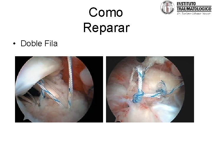 Como Reparar • Doble Fila 