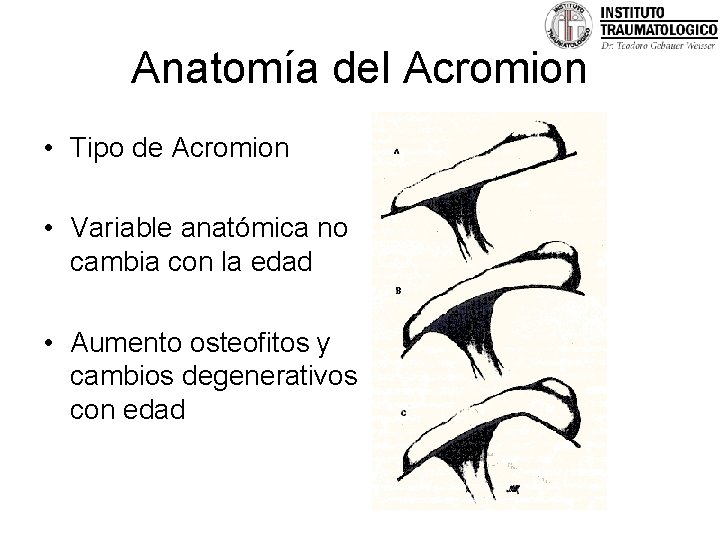 Anatomía del Acromion • Tipo de Acromion • Variable anatómica no cambia con la